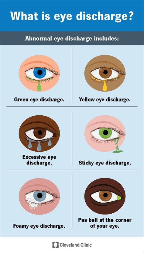 how to get rid of eye mucus.